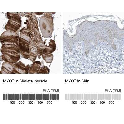 Immunohistochemistry-Paraffin: Myotilin Antibody [NBP1-87851]