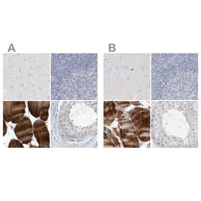 Immunohistochemistry-Paraffin: Myotilin Antibody [NBP1-87851]