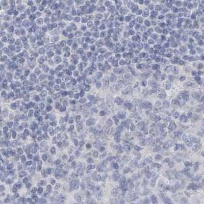 Immunohistochemistry-Paraffin: Myotilin Antibody [NBP1-87851]