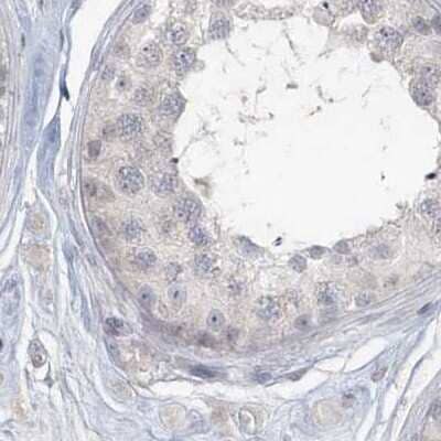 Immunohistochemistry-Paraffin: Myotilin Antibody [NBP1-87851]