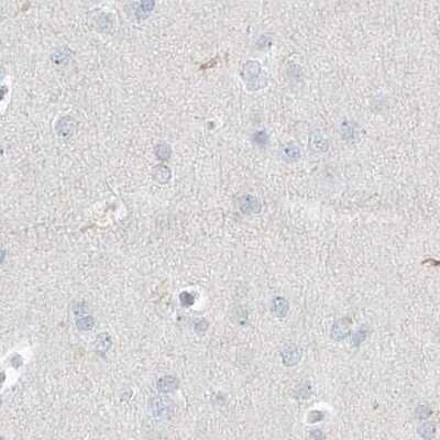 Immunohistochemistry-Paraffin: Myotilin Antibody [NBP1-87851]