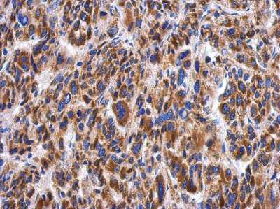 Immunohistochemistry-Paraffin: Myotilin Antibody [NBP2-19455]