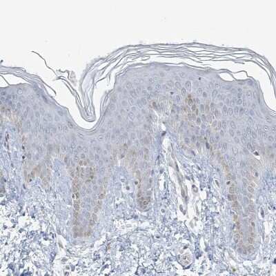 Immunohistochemistry-Paraffin: Myotilin Antibody [NBP2-38361]