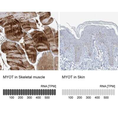 Immunohistochemistry-Paraffin: Myotilin Antibody [NBP2-38361]