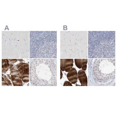 Immunohistochemistry-Paraffin: Myotilin Antibody [NBP2-38361]