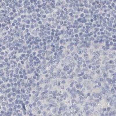 Immunohistochemistry-Paraffin: Myotilin Antibody [NBP2-38361]
