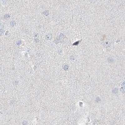 Immunohistochemistry-Paraffin: Myotilin Antibody [NBP2-38361]