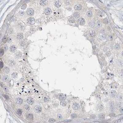 Immunohistochemistry-Paraffin: Myotilin Antibody [NBP2-38361]