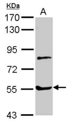 Western Blot: Myotilin Antibody [NBP2-19455]