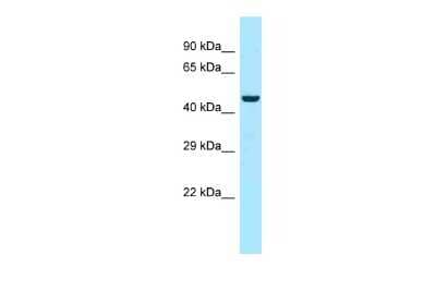 Western Blot: Myotilin Antibody [NBP2-87867]