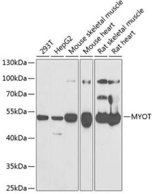 Western Blot: Myotilin AntibodyBSA Free [NBP2-94022]