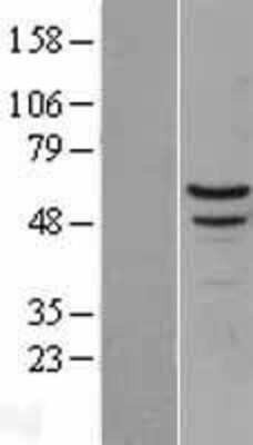 Western Blot: Myotilin Overexpression Lysate [NBL1-13445]