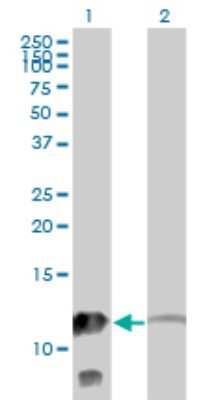 Western Blot: Myotrophin Antibody (1F3) [H00136319-M14]