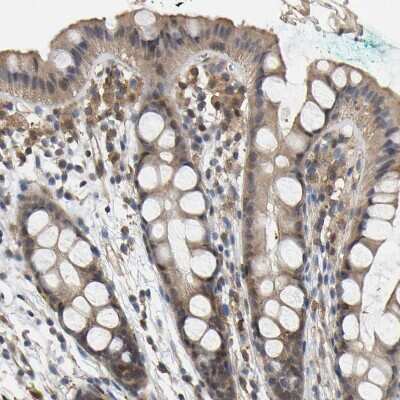 Immunohistochemistry-Paraffin: Myotrophin Antibody [NBP1-89787]