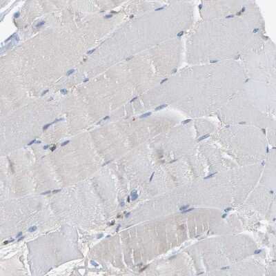 Immunohistochemistry-Paraffin: Myotrophin Antibody [NBP1-89787]