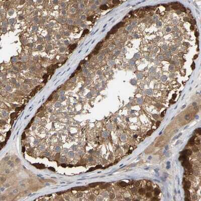Immunohistochemistry-Paraffin: Myotrophin Antibody [NBP1-89787]