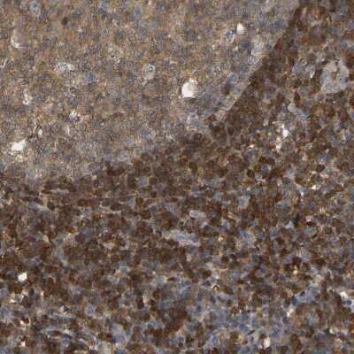 Immunohistochemistry-Paraffin: Myotrophin Antibody [NBP1-89787]