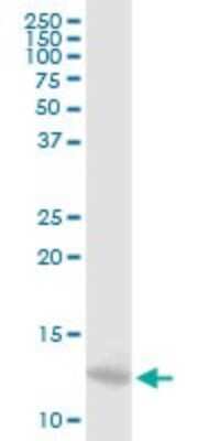 Western Blot: Myotrophin Antibody [H00136319-B03P]