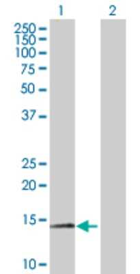 Western Blot: Myotrophin Antibody [H00136319-B03P]