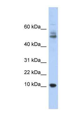 Western Blot: Myotrophin Antibody [NBP1-54959]