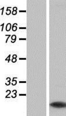 Western Blot: Myotrophin Overexpression Lysate [NBP2-05463]