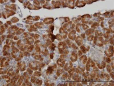 Immunohistochemistry-Paraffin: Myotubularin Antibody (1C10) [H00004534-M01]