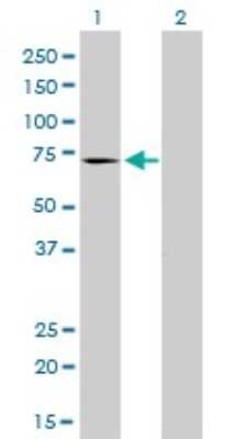 Western Blot: Myotubularin Antibody (1C10) [H00004534-M01]