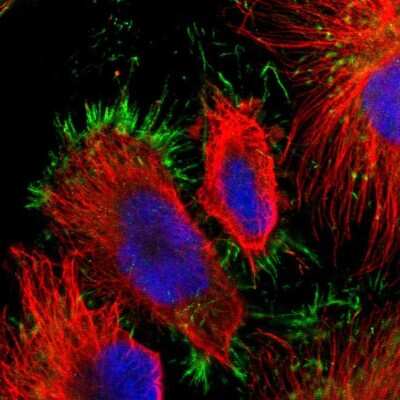 Immunocytochemistry/ Immunofluorescence: Myotubularin Antibody [NBP1-86113]