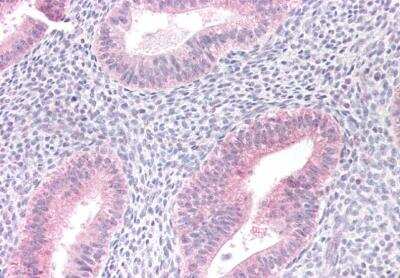 Immunohistochemistry-Paraffin: Myotubularin Antibody [NB300-949]