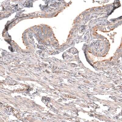Immunohistochemistry-Paraffin: Myotubularin Antibody [NBP1-86113]