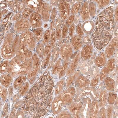 Immunohistochemistry-Paraffin: Myotubularin Antibody [NBP1-86113]