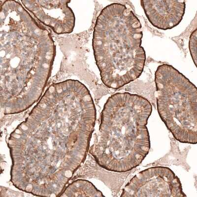 Immunohistochemistry-Paraffin: Myotubularin Antibody [NBP1-86113]