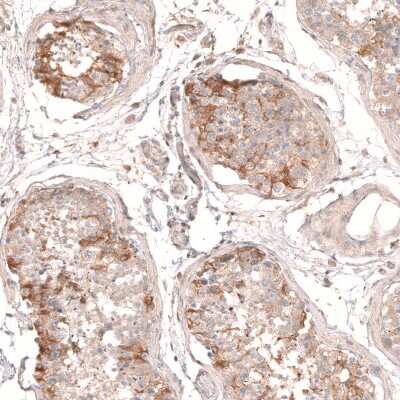 Immunohistochemistry-Paraffin: Myotubularin Antibody [NBP1-86113]