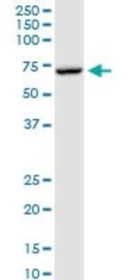 Western Blot: Myotubularin Antibody [H00004534-D01P]