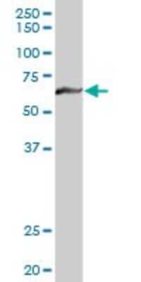 Western Blot: Myotubularin Antibody [H00004534-D01P]