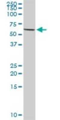 Western Blot: Myotubularin Antibody [H00004534-D01P]