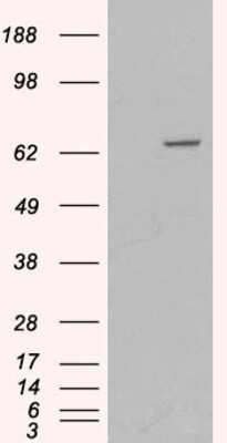 Western Blot: Myotubularin Antibody [NB300-949]