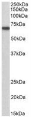Western Blot: Myotubularin Antibody [NB300-949]