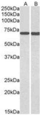 Western Blot: Myotubularin Antibody [NB300-949]