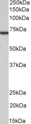 Western Blot: Myotubularin Antibody [NB300-949]