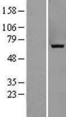 Western Blot: Myotubularin Overexpression Lysate [NBL1-13369]