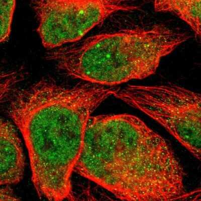 Immunocytochemistry/ Immunofluorescence: Myotubularin Related Protein 10 Antibody [NBP2-30553]