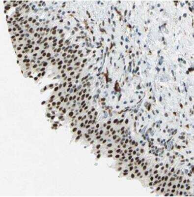 Immunohistochemistry: Myotubularin Related Protein 10 Antibody [NBP2-30553]