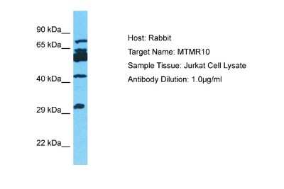 Western Blot: Myotubularin Related Protein 10 Antibody [NBP2-83246]