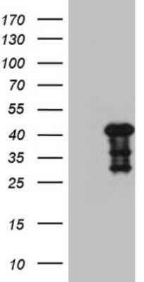 Western Blot: Myozenin 1 Antibody (OTI4C2) [NBP2-46071]