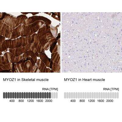 Immunohistochemistry-Paraffin: Myozenin 1 Antibody [NBP1-85439]