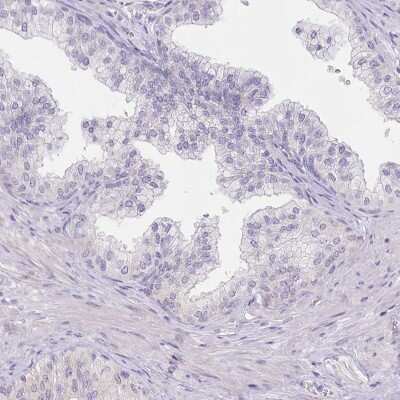 Immunohistochemistry-Paraffin: Myozenin 1 Antibody [NBP2-38412]