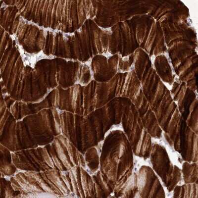 Immunohistochemistry-Paraffin: Myozenin 1 Antibody [NBP2-38412]