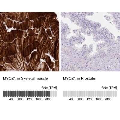 Immunohistochemistry-Paraffin: Myozenin 1 Antibody [NBP2-38412]