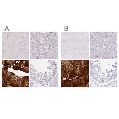 Immunohistochemistry-Paraffin: Myozenin 1 Antibody [NBP2-38412]
